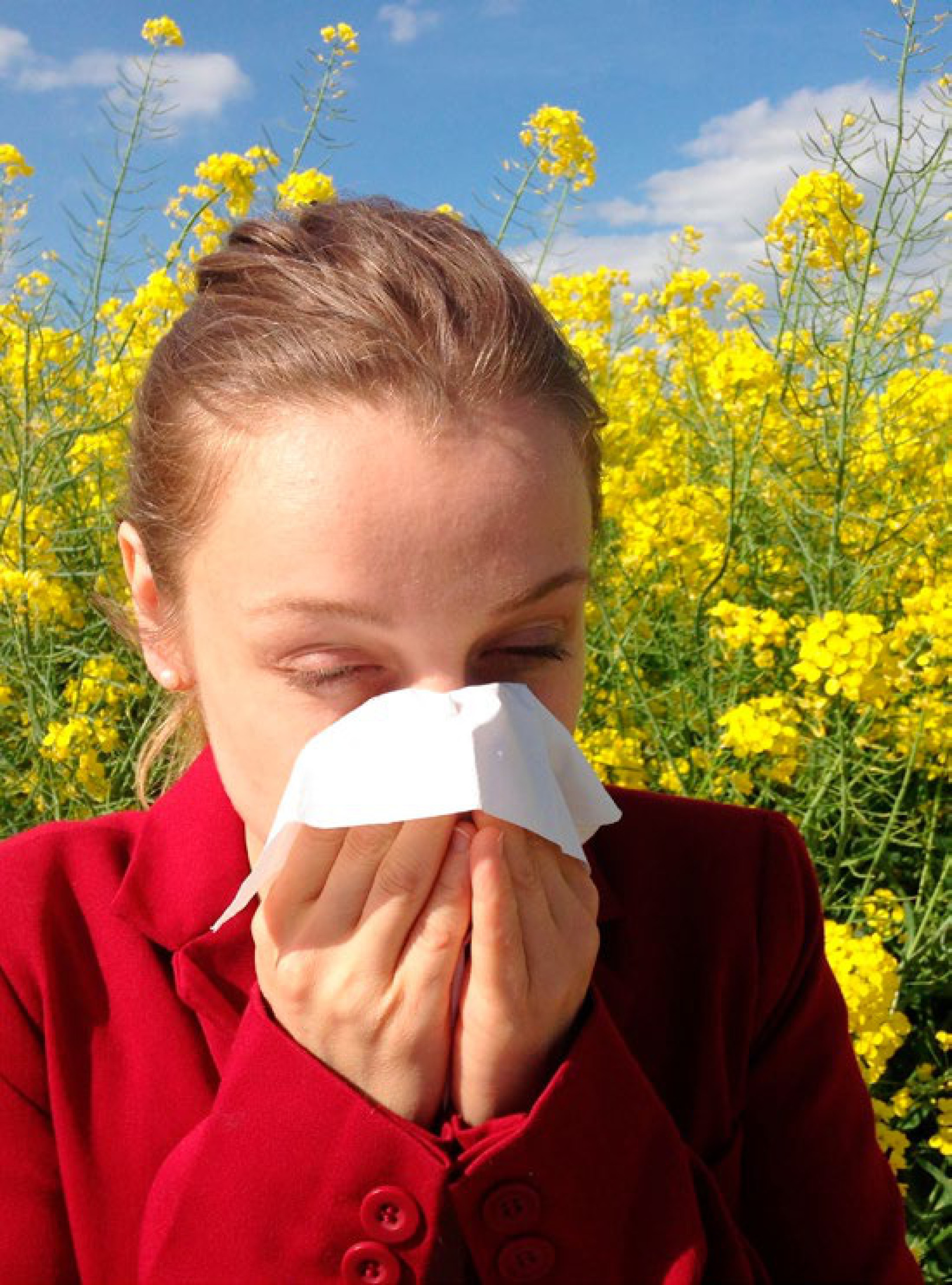 Jetzt beginnt die Pollen-Hochsaison