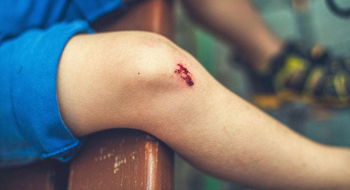 Auch kleine Wunden sind Eintrittspforten für Infekte. BILD: MARKUS SPISKE, UNSPLASH