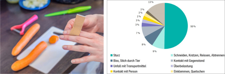 Schnittverletzungen in der Küche kommen gar nicht so häufig vor, wie man denken mag. Stattdessen zeigen die Erhebungen der BFU (Grafik rechts): Stürze sind mit Abstand die Hauptunfallart in Heim und Freizeit (in den Jahren 2017 bis 2021). BILD: STATUSBERICHT BFU